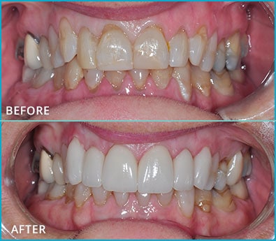 Before and After Case 2