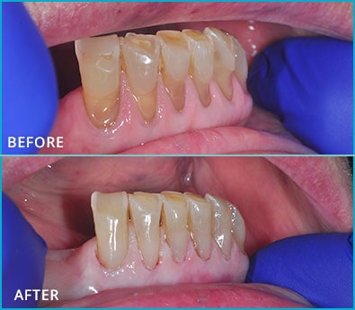 Before and After Case 3