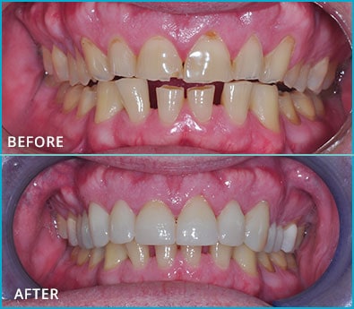 Before and After Case 7