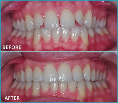 Before and After Case 8