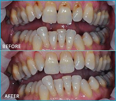 Before and After Case 9