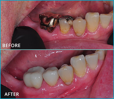 Before and After Case 16