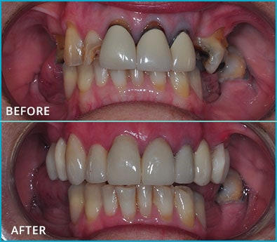 Before and After Case 19