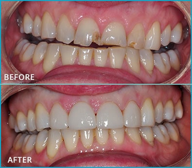 Before and After Case 29